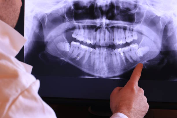 Best Walk-In Emergency Dentist in Baraga, MI